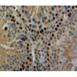 Parathyroid Hormone-Related Protein / PTHrP (PTHLH) Antibody