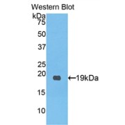 Western blot analysis of the recombinant protein.