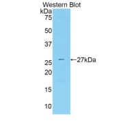 Western blot analysis of the recombinant protein.