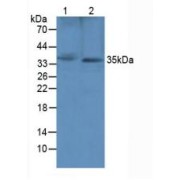 Western blot analysis of (1) Rat Heart Tissue and (2) Rat Brain Tissue.
