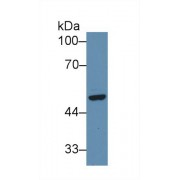 Western blot analysis of Human HeLa cell lysate, using Human SFRP4 Antibody (3 µg/ml) and HRP-conjugated Goat Anti-Rabbit antibody (<a href="https://www.abbexa.com/index.php?route=product/search&amp;search=abx400043" target="_blank">abx400043</a>, 0.2 µg/ml).