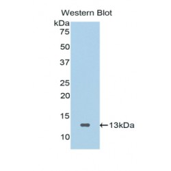 Secreted Frizzled Related Protein 4 (SFRP4) Antibody