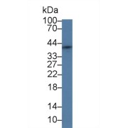 Western blot analysis of Human HeLa cell lysate, using Rat SFRP4 Antibody (2 µg/ml) and HRP-conjugated Goat Anti-Rabbit antibody (<a href="https://www.abbexa.com/index.php?route=product/search&amp;search=abx400043" target="_blank">abx400043</a>, 0.2 µg/ml).