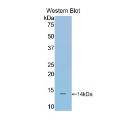 Secreted Frizzled Related Protein 4 (SFRP4) Antibody