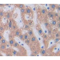 Secreted Frizzled Related Protein 4 (SFRP4) Antibody