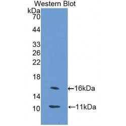 Solute Carrier Family 30 Member 8 (SLC30A8) Antibody