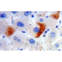 Solute Carrier Family 30 Member 8 (SLC30A8) Antibody