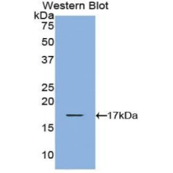 T-Cell Leukemia/Lymphoma Protein 1A (TCL1A) Antibody