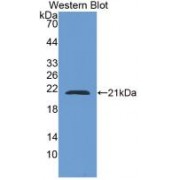 Western blot analysis of recombinant Human CAP2.