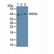 Western blot analysis of (1) Human Serum, (2) Human Liver Tissue and (3) Human Lung Tissue.