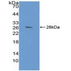 Zinc-Alpha-2-Glycoprotein (AZGP1) Antibody