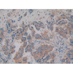 Zinc-Alpha-2-Glycoprotein (AZGP1) Antibody