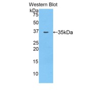 Western blot analysis of the recombinant protein.