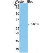 Western blot analysis of recombinant Human CNTFR Protein.
