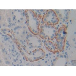 Ciliary Neurotrophic Factor Receptor (CNTFR) Antibody