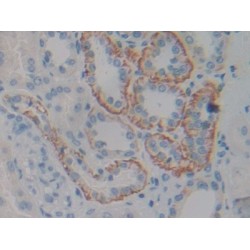 Ciliary Neurotrophic Factor Receptor (CNTFR) Antibody