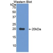 Western blot analysis of the recombinant protein.