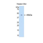 abx103905