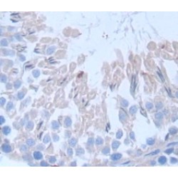 Fibrous Sheath Interacting Protein 1 (FSIP1) Antibody