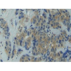Heat Shock Protein 90 kDa Alpha A1 (HSP90aA1) Antibody