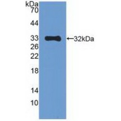 Mitogen-Activated Protein Kinase 10 / JNK3 (MAPK10) Antibody