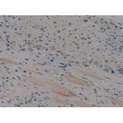 Mitogen-Activated Protein Kinase 11 (MAPK11) Antibody