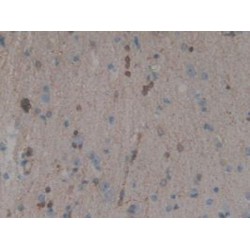 Mitogen-Activated Protein Kinase 11 (MAPK11) Antibody
