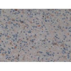 Mitogen-Activated Protein Kinase 11 (MAPK11) Antibody