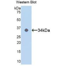 Mitogen-Activated Protein Kinase 14 (MAPK14) Antibody