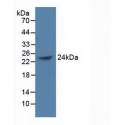 Polycomb Group Ring Finger Protein 4 (PCGF4) Antibody