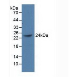 Polycomb Group Ring Finger Protein 4 (PCGF4) Antibody