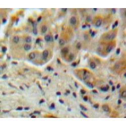 Protein Z Dependent Protease Inhibitor (ZPI) Antibody