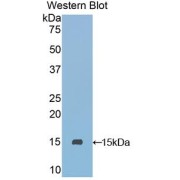 Western blot analysis of the recombinant protein.