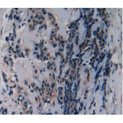 Secreted Ly6/uPAR Related Protein 1 (SLURP1) Antibody