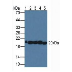 Superoxide Dismutase 2 (SOD2) Antibody