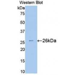 Superoxide Dismutase 3 (SOD3) Antibody