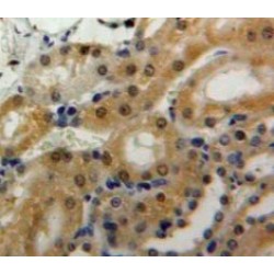 Superoxide Dismutase 3 (SOD3) Antibody