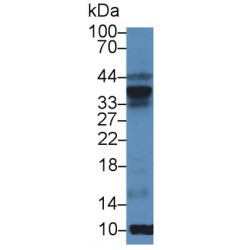 Superoxide Dismutase 3 (SOD3) Antibody