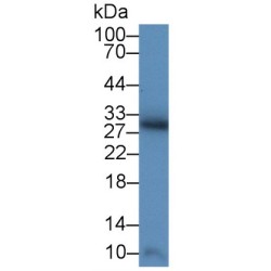 Superoxide Dismutase 3 (SOD3) Antibody