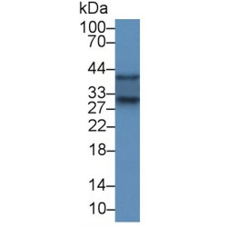 Superoxide Dismutase 3 (SOD3) Antibody