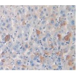 C-C Motif Chemokine 17 (CCL17) Antibody