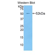 Western blot analysis of the recombinant protein.