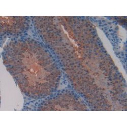 Transcription Factor A, Mitochondrial (TFAM) Antibody