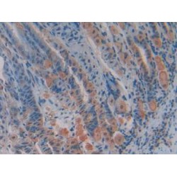 Transcription Factor A, Mitochondrial (TFAM) Antibody