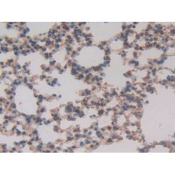 Transcription Factor A, Mitochondrial (TFAM) Antibody