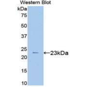 abx103961