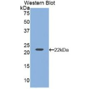 Western blot analysis of recombinant Rat VEGFA.
