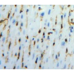 Vascular Endothelial Growth Factor A (VEGFA) Antibody