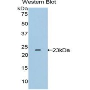 abx103970