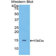 abx103974